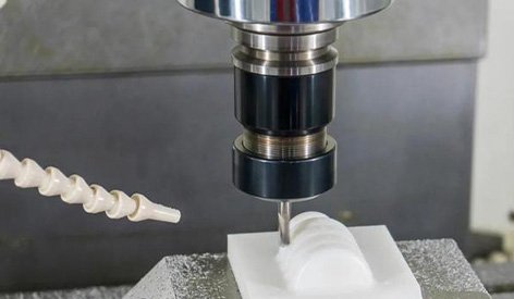 Medical device manufacturing